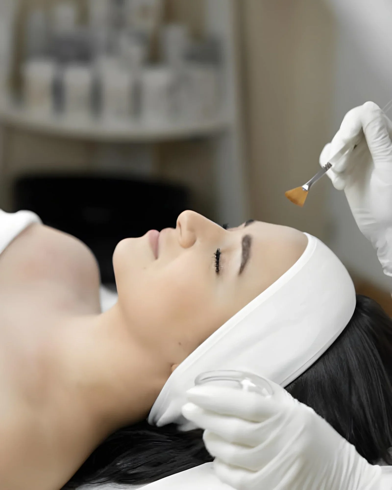 chemical peel 2