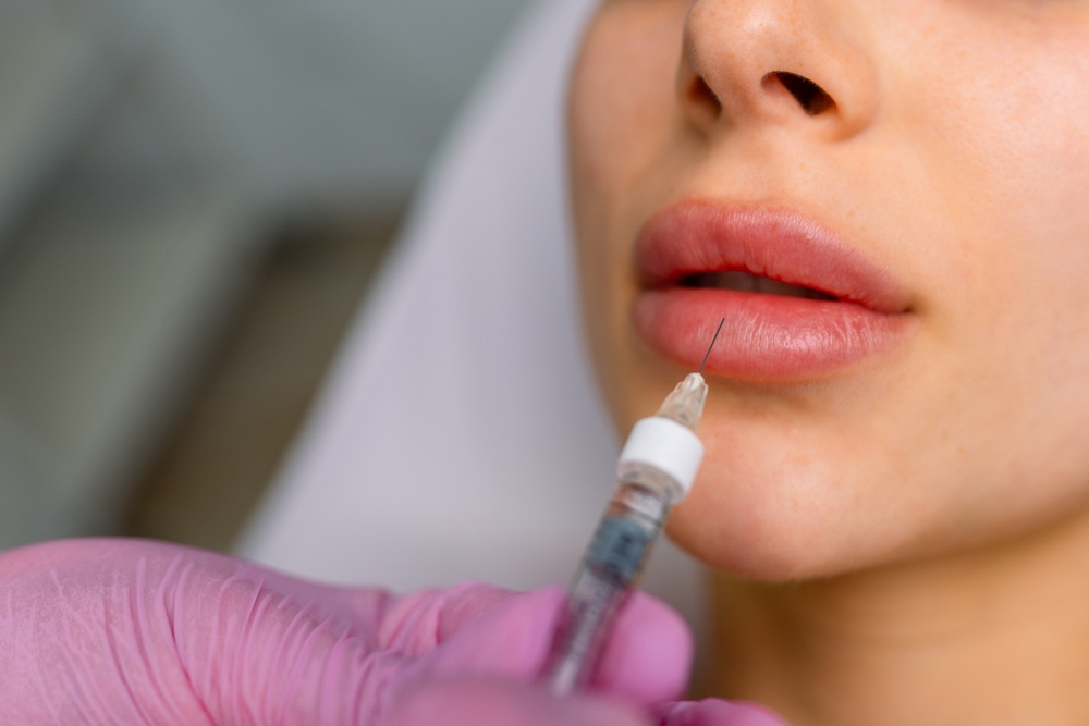 Lip Filler in Almont MI